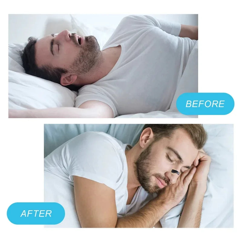 Magnetic Nasal Dilator Starter Kit For Better Sleep Snoring Reduction